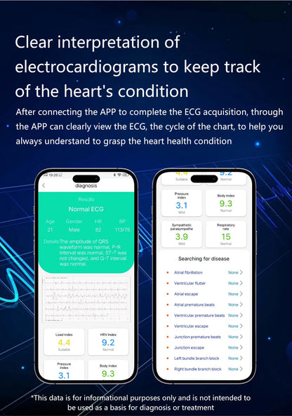 2026 New Upgrade Air Pump Blood Pressure Accurate Measure SmartWatch ECG Micro Physical Examination NFC Airbag Smart Watches Man